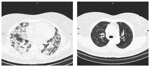 Introducing BAO da Whale (custom pretrain) 1000 EP. Read the description. AI cover generator