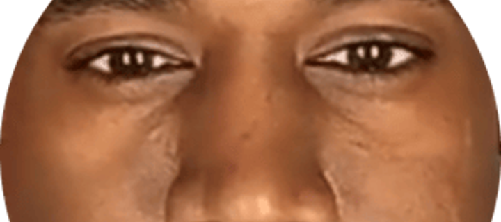 This is the Avatar Image for the Kanye West (Ye Era) (Ov2) AI Voice and Text to Speech Generator